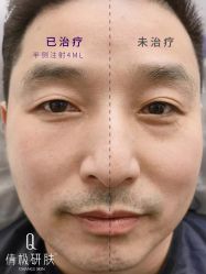 -倩极·精研痘敏肌管理
