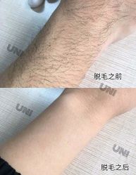 点击看大图 -ANRI安里·专业男士脱毛连锁