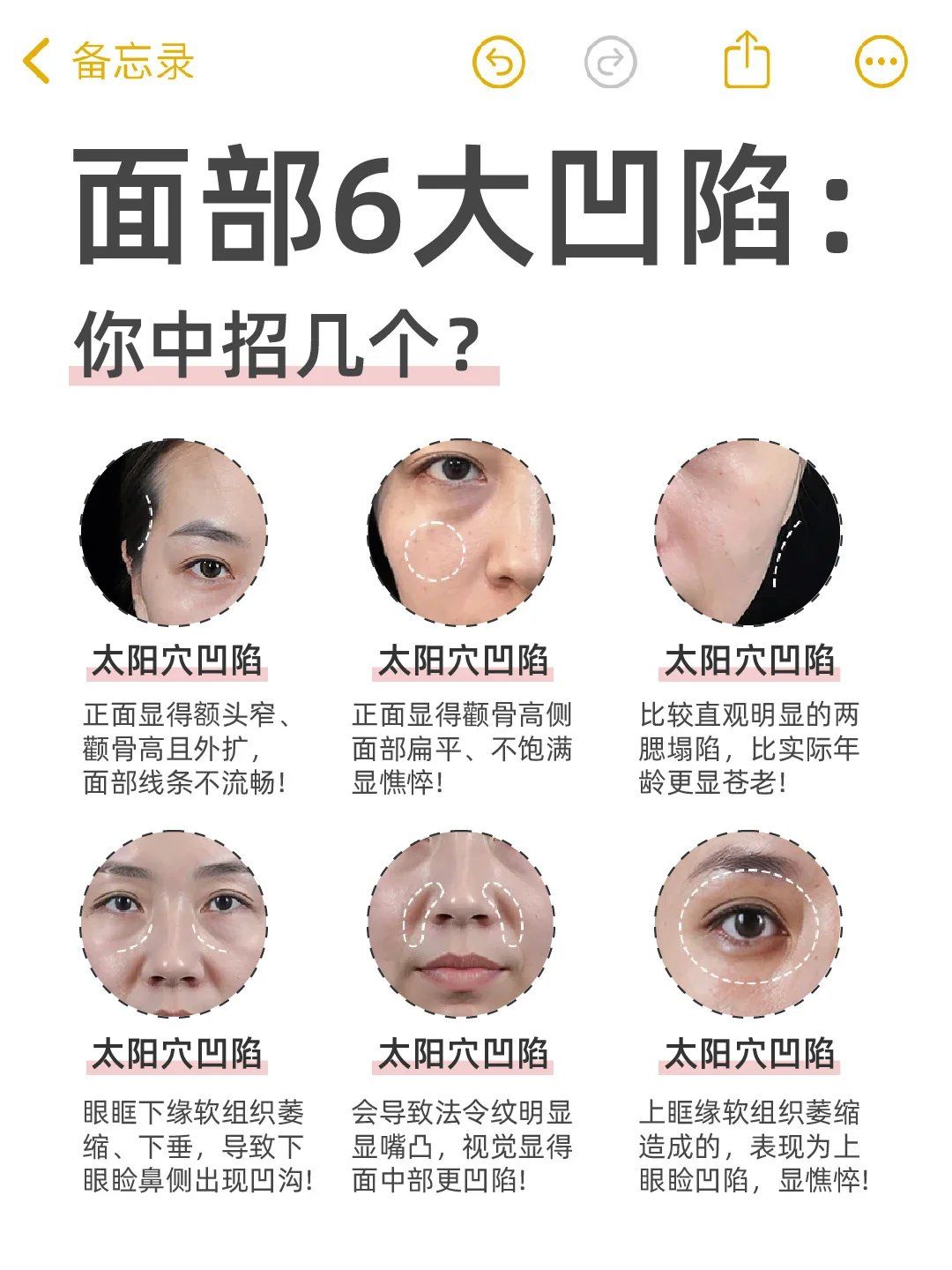 全脸!面部凹陷拯救攻略,看这一篇就够了