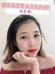 -大麦微针植发全国连锁