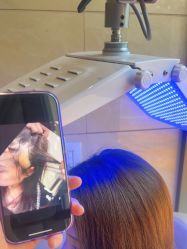 -碧莲盛·不剃发植发