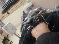 -杭州仁易堂中医康复医院疤痕修复