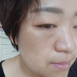 -八大处整形