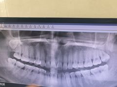 -南方医科大学口腔医院(番禺院区)