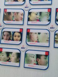 -悟空祛痘·诺奖技术专业店