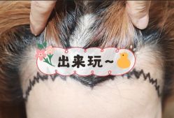-大麦微针植发全国连锁