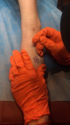 点击看大图 -新肤洗纹身