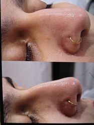 -SKIN79皮肤管理中心