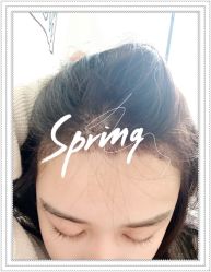 点击看大图 -大麦微针植发全国连锁