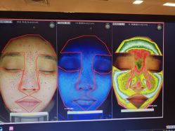 皮肤检测-光SPA科技美肤