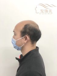 -发饰美男士增发补发假发定制店