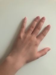 -薇兰专业脱毛连锁机构