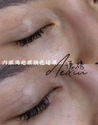 -德绣·机器野生眉发际线·美瞳线半永久