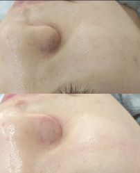 点击看大图 -SKIN79皮肤管理中心