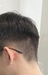 -天使之手