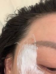 -海涛医疗美容·面部抗衰·注射美鼻