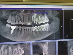 -佛山中大口腔医院·市二级口腔专科医院