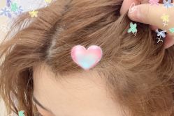 -大麦微针植发全国连锁