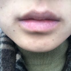 -一美医疗美容