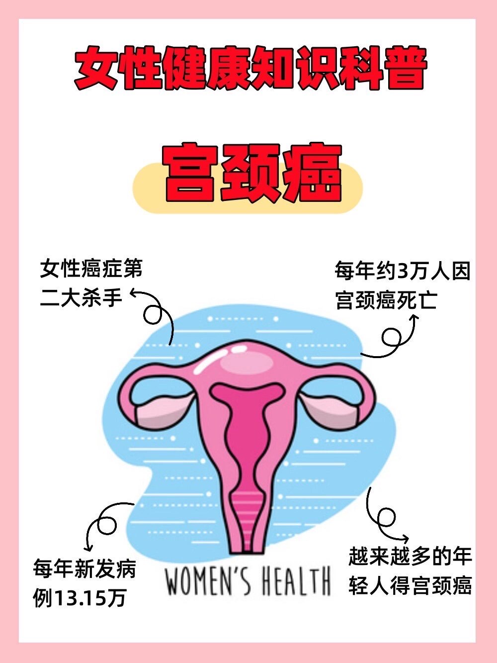 宫颈癌照片 女性图片