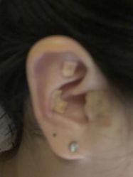 -肥三针腧穴瘦身馆