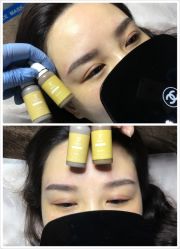 点击看大图 -郡艺医疗美容·微整·眼鼻吸脂
