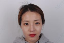 -Metime美天医疗美容