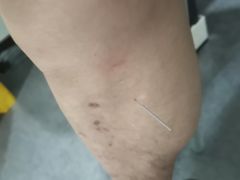 -悦和堂中医门诊部·疼痛调理·针灸推拿·艾灸拔罐