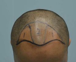 体验前-厦门美莱整形美容医院