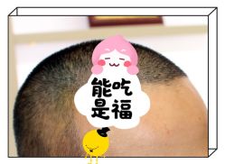 -大麦微针植发全国连锁