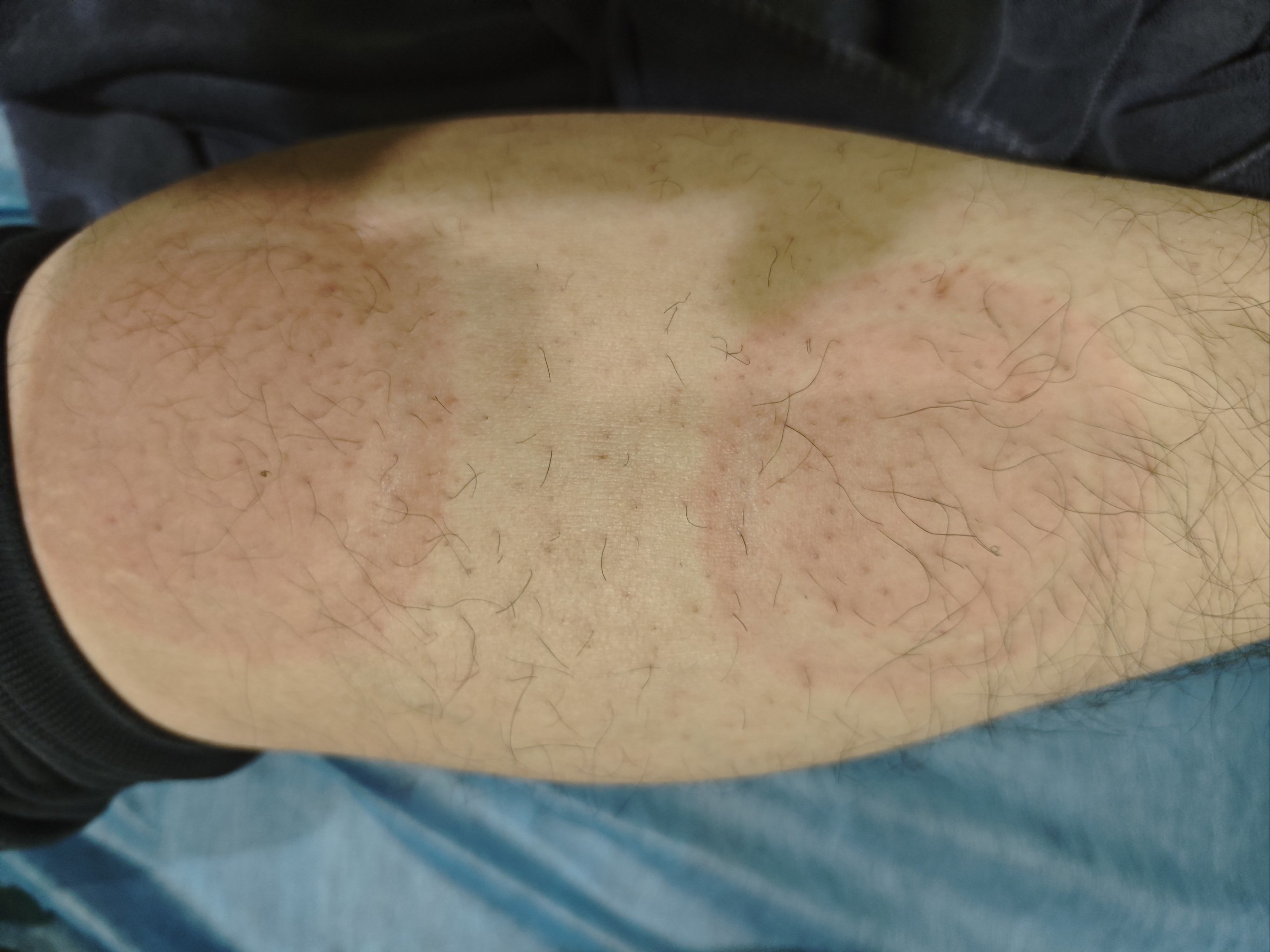 专业理疗,身心都轻松