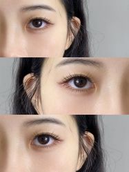 -宥莉·ULLY 痘敏肌•科技皮肤管理中心