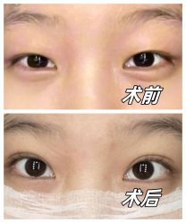 -深圳艺星医疗美容医院