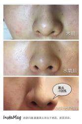 脸部抗衰-光SPA科技美肤