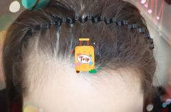 -大麦微针植发全国连锁