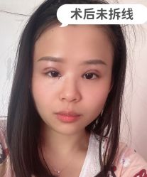 -素美医疗美容·西南眼鼻整形·修复基地