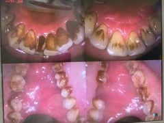 -惠州口腔医院(下埔总院)