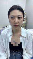 -海涛医疗美容·面部抗衰·注射美鼻