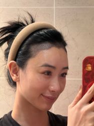 -大麦微针植发丨全国连锁