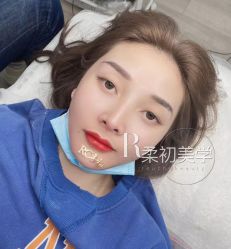 -RC半永久纹眉纹发际线