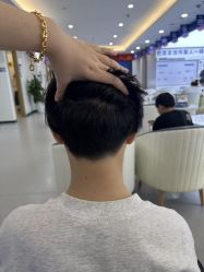 -大麦微针植发全国连锁