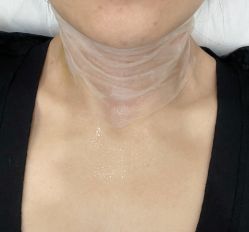 -海涛医疗美容·面部抗衰·注射美鼻