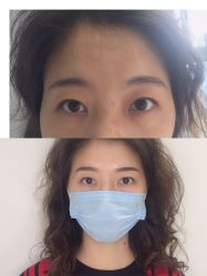 -MIVI半永久纹眉绣眉