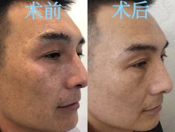 -北京米扬丽格医疗美容·联合丽格鼻整形中心