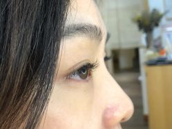 -宥莉·ULLY 痘敏肌•科技皮肤管理中心