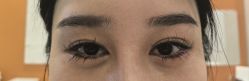 -长沙雅美医疗美容医院