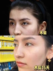 -上海伊莱美医疗美容医院