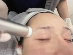 体验后-杭州医巢医疗美容