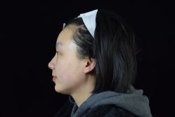 点击看大图 体验后-Yestar重庆艺星医疗美容医院