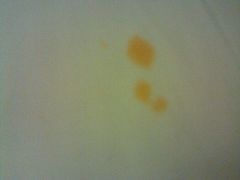 床单床罩的污渍-王府半岛酒店